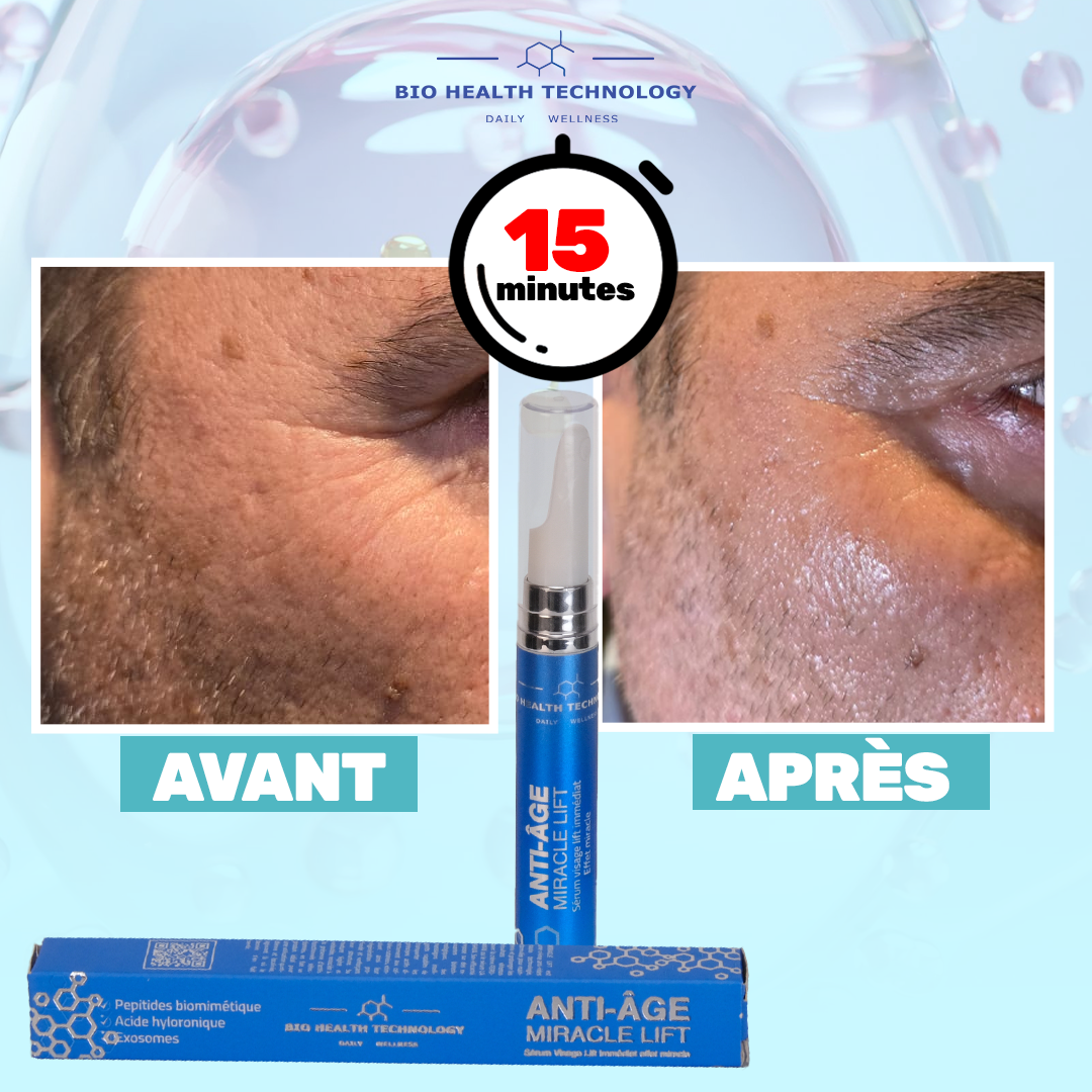 Miracle Lift offert