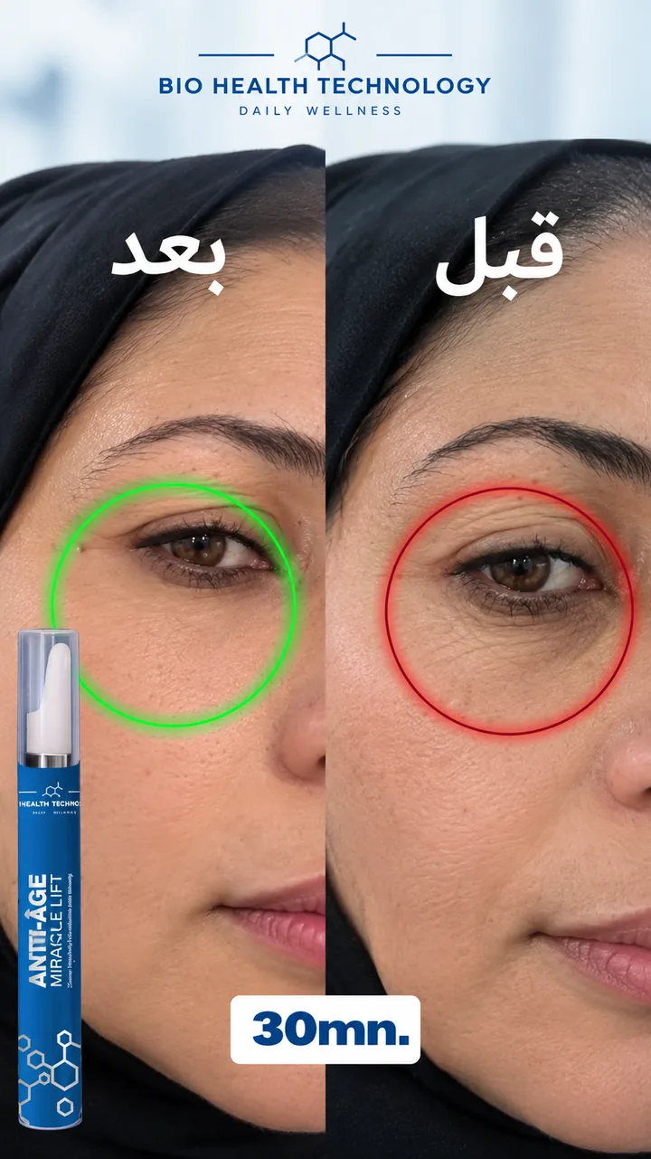 Miracle Lift avant / après 30 min, contour des yeux