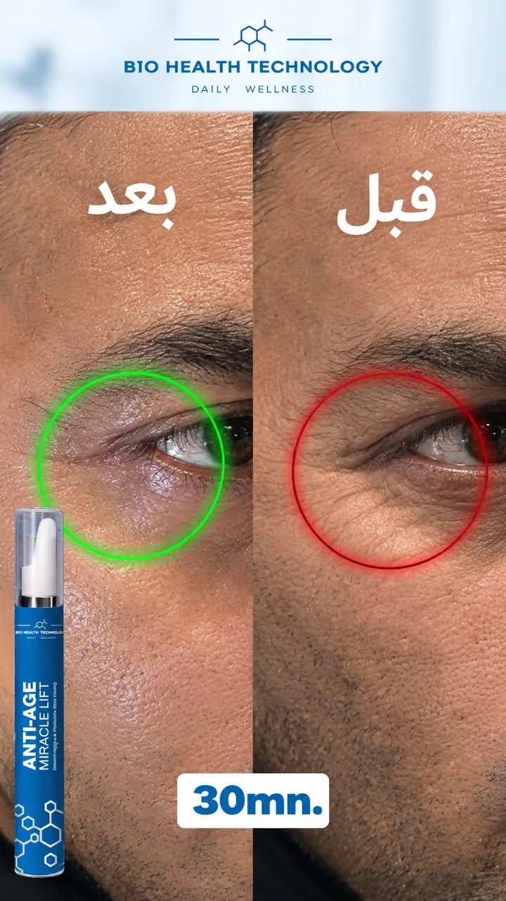 Miracle Lift avant / après, cernes et ridules